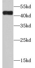      anti- ADH1C antibody