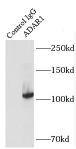      anti- ADAR1 antibody