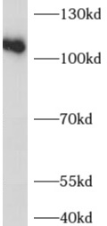      anti- ADAR1 antibody