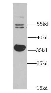      anti- AKR1C3 antibody