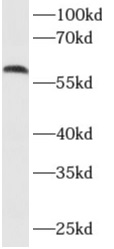      anti- AKT3 antibody