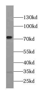      anti- AGS3 antibody