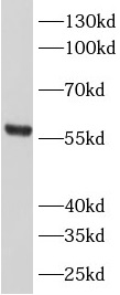      anti- Ajuba antibody