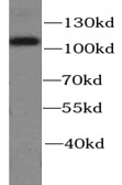      anti- Alpha E catenin antibody