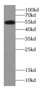 Alpha-2-antiplasmin 抗体