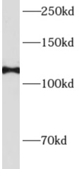      anti- Alpha adducin antibody