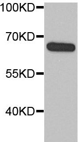      anti- AEG-1/MTDH-Specific antibody