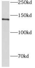      anti- Aldehyde oxidase antibody