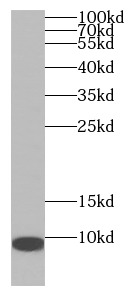      anti- Adrenomedullin antibody