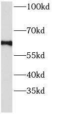      anti- Angiopoietin 2 antibody