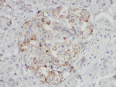      anti- 15 Lipoxygenase 2 antibody