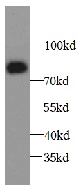      anti- 15 Lipoxygenase 2 antibody