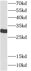      anti- 14-3-3 epsilon antibody