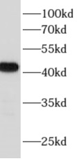      anti- Alpha actin antibody