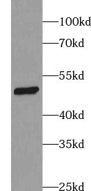      anti- ACADL-Specific antibody