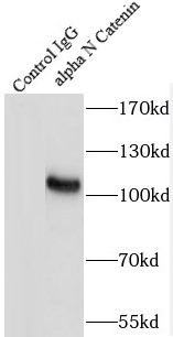 alpha N Catenin抗体
