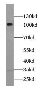      anti- alpha N Catenin antibody