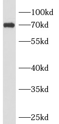 anti- ANKRD13B antibody