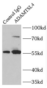 ADAMTSL4抗体
