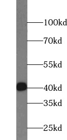      anti- AP1,JUN,P39 antibody