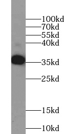      anti- AASDHPPT antibody