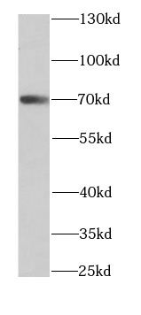      anti- ARHGAP25 antibody