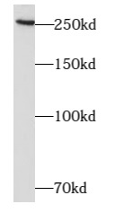      anti- ARHGAP21 antibody