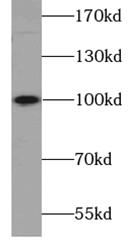      anti- ATP1A2-Specific antibody