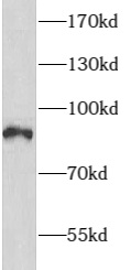      anti- ARHGAP10 antibody