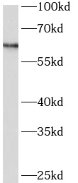      anti- Arylsulfatase D antibody