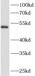      anti- ANKRD13D antibody