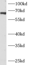      anti- ANKRD13C antibody