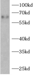      anti- ARHGAP15 antibody