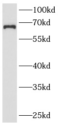      anti- ANKRD13A antibody