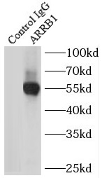      anti- beta Arrestin 1 antibody