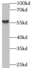      anti- beta Arrestin 1 antibody