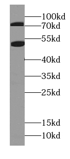      anti- Bestrophin-3 antibody