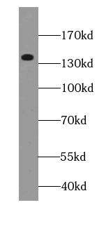 anti- BAI3-Specific antibody