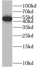      anti- Beta Arrestin 2 antibody