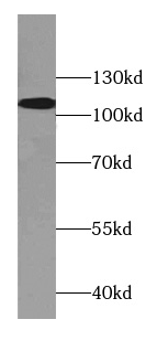      anti- Beta adducin antibody