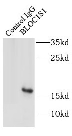      anti- BLOC1S1-Specific antibody