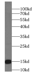      anti- BLOC1S1-Specific antibody