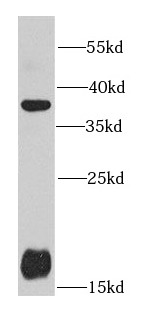      anti- AMPK beta 1 antibody