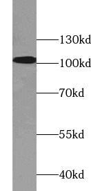      anti- alpha Actinin antibody