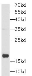      anti- alpha-synuclein antibody