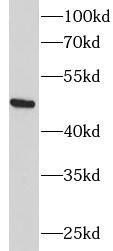      anti- ADRP/Perilipin 2 antibody