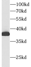      anti- Aldolase C antibody