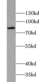      anti- Aconitase 2 antibody