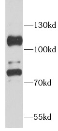      anti- Aconitase 1 antibody