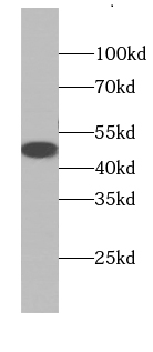      anti- BAG1S-specific antibody